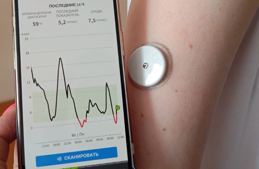 Диабет в приложении: в Каменске-Уральском медики контролируют заболевание через телефон