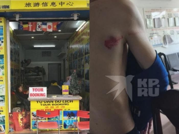 Украли мопед и паспорт, избили: турист из Екатеринбурга застрял во Вьетнаме