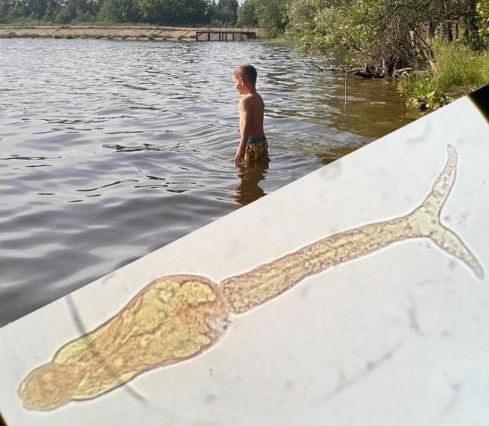 «В кожу въелся паразит»: малышка покрылась сыпью после купания в уральском водоеме