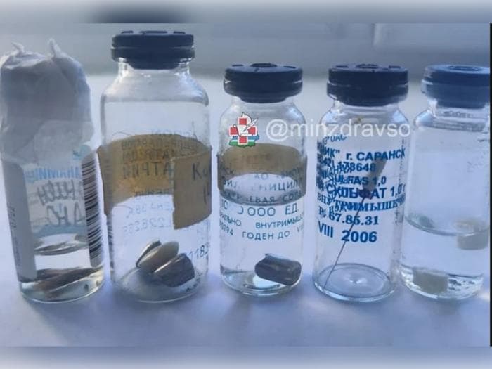 В Свердловской области врачи извлекли пулю, осколок снаряда и стекло из легких пациентов