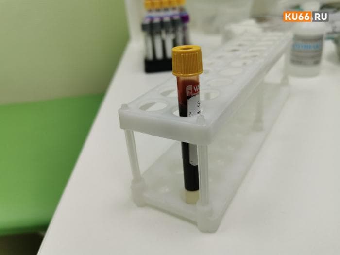 «Вечный яд» в крови человека обнаружили ученые. Что это и как с этим жить?