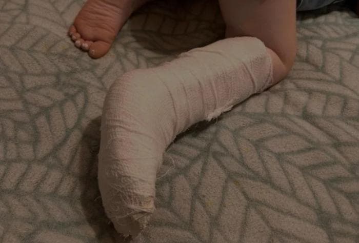 После девяти месяцев молчания: Следком возбудил дело по травме ребенка в детсаду Каменска-Уральского