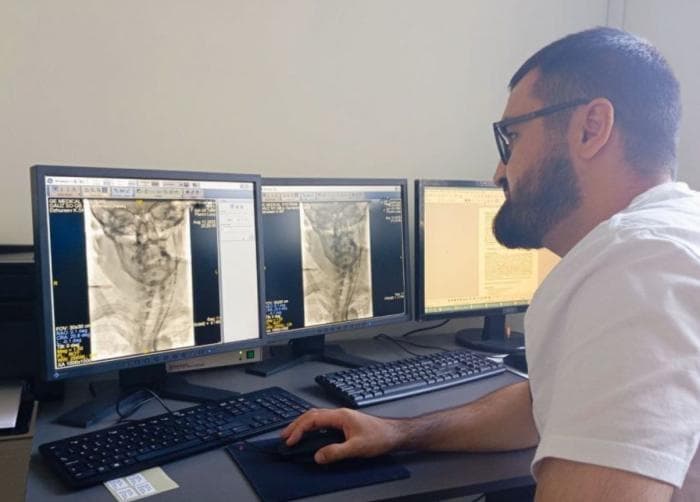 «Буквально пробились к мозгу»: Врачи Каменска-Уральского спасли женщину с инсультом