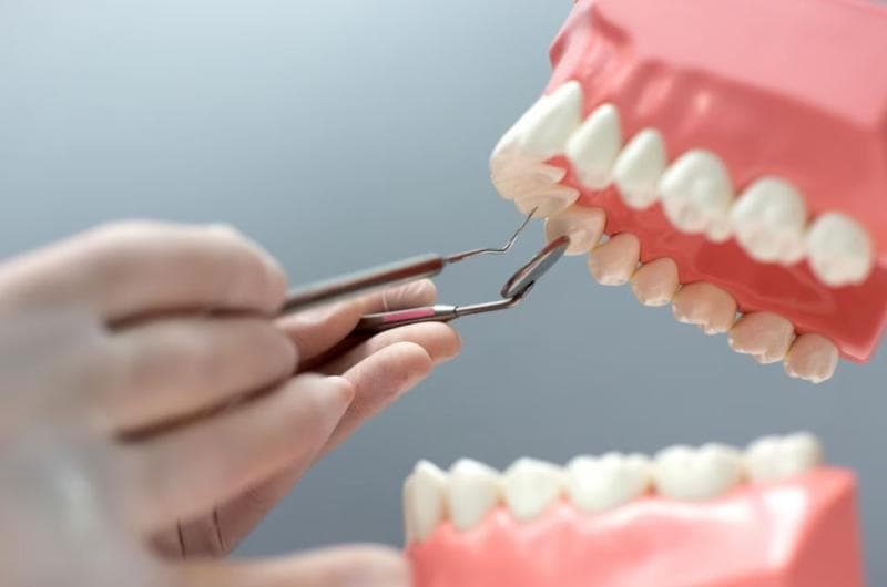 Стоматолог рассказал, почему домашнее отбеливание зубов рисовой водой и содой опасно