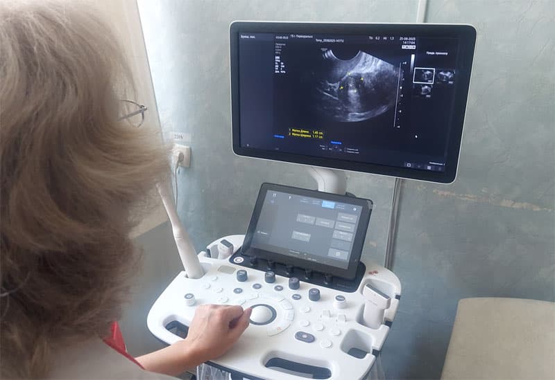 В Свердловской области закупят 1111 единиц медоборудования на 2,8 млрд