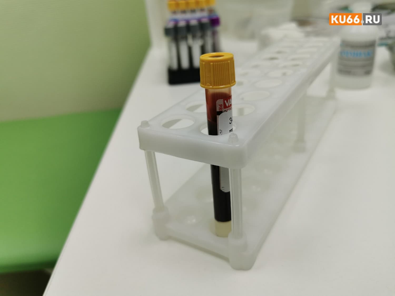 У более половины россиян не нашли иммунитета к кори