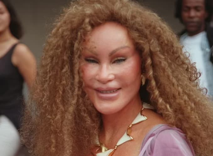 Умерла знаменитая "женщина-кошка": Джослин Вильденштейн было 84 года