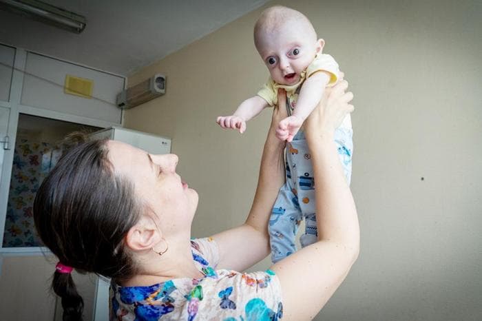 «При рождении остановилось сердце»: мальчик с необычной внешностью родился в Каменске-Уральском